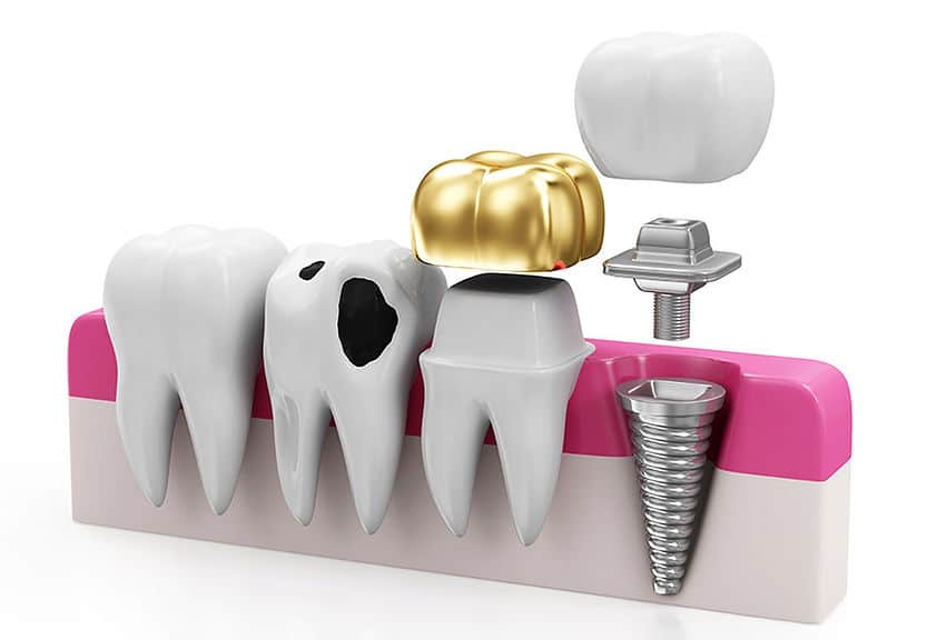 Restorative Dentistry